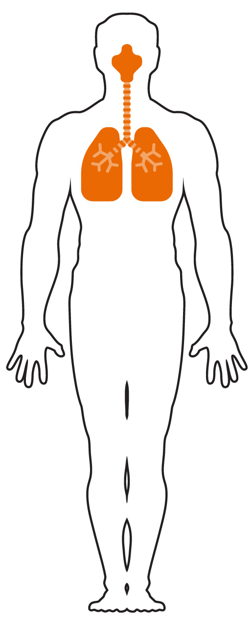 Chemical Weapons A Deadly History Radio Free Europe / Radio Liberty